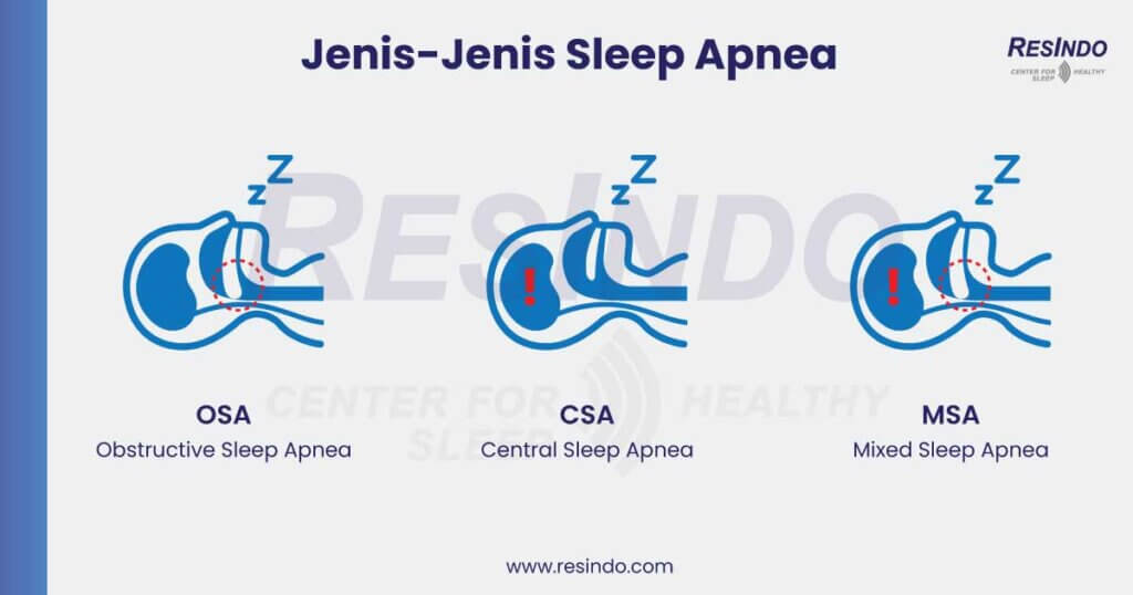 Jenis Sleep Apnea