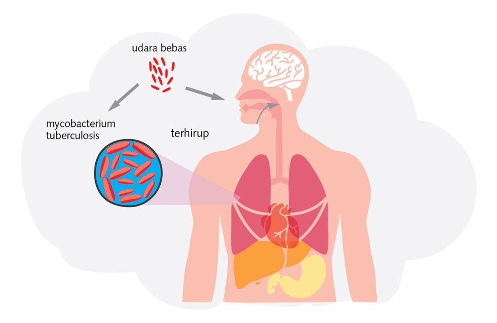 Penyakit Tuberkulosis Menular