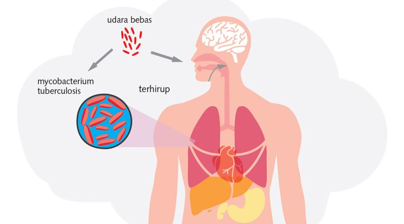 Penyakit Tuberkulosis Menular