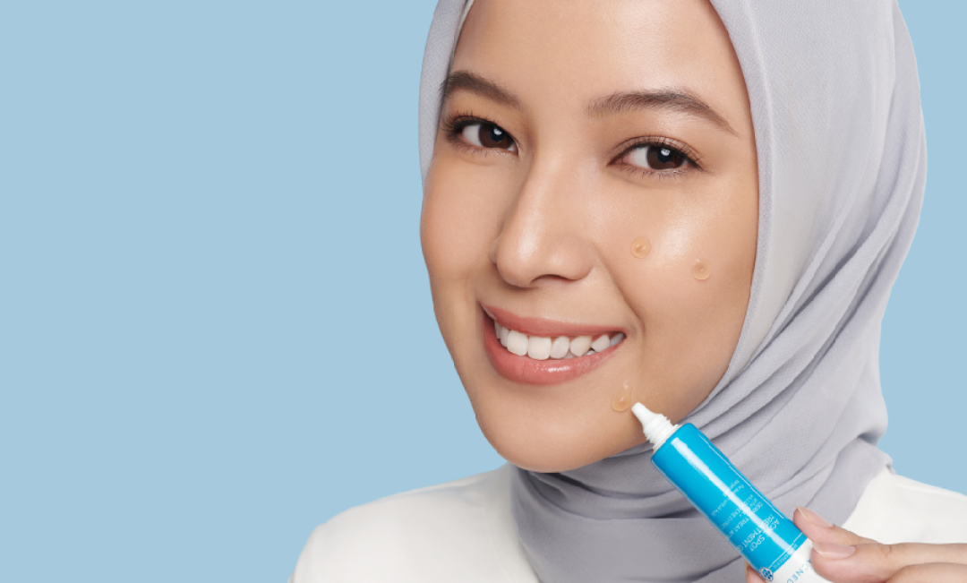 Spot Treatment Wajah: Rahasia Menghilangkan Jerawat Tanpa Mengganggu Kulit Sehat